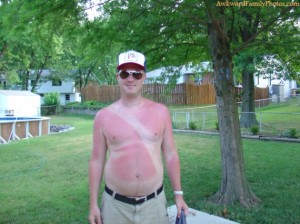 Not sure if those are his tan lines or he doesn't know how to put on sunscreen correctly. Either way, he might need to apply the Aloe Vera.